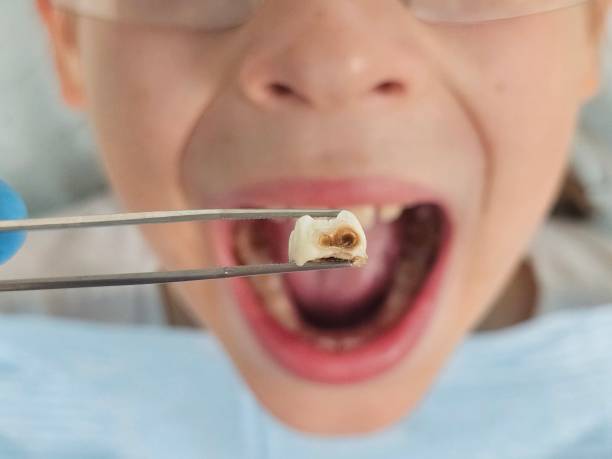 Best Weekend Emergency Dentist in Gillett, WI